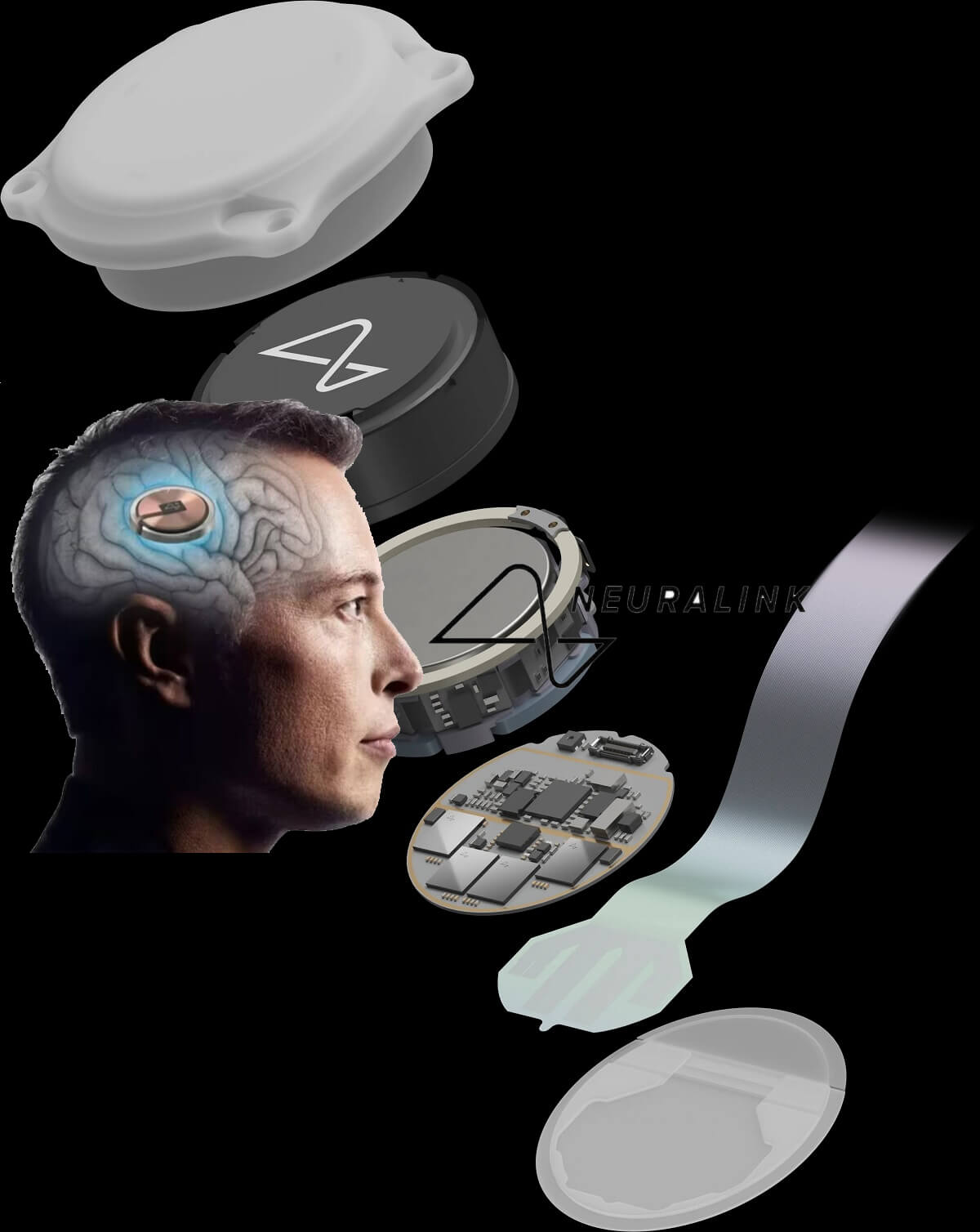 Neuralink and Brain Implants